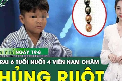 Bản tin Y tế 19/8: Nuốt 4 viên nam châm, bé trai 6 tuổi thủng ruột