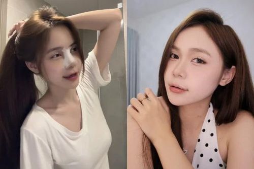 Hot Tiktoker La Hoàng Kỳ Duyên sửa mũi để 'nâng tầm' nhan sắc