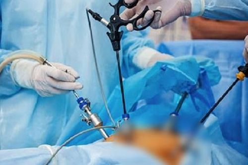 Người phụ nữ phải cắt bỏ túi mật từ triệu chứng buồn nôn, đau bụng
