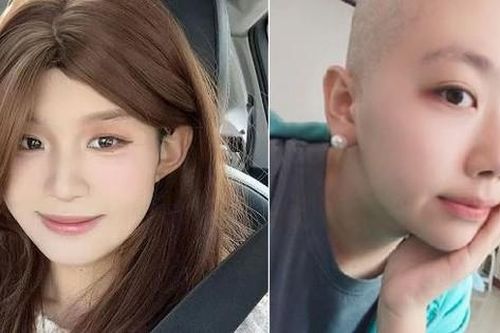 Thường xuyên ăn món khoái khẩu, cô gái 25 tuổi qua đời vì ung thư dạ dày