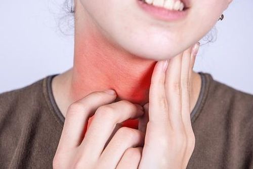 Đau họng kéo dài do viêm amidan hốc mủ