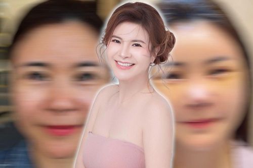 Nữ diễn viên Vbiz lên tiếng về chuyện 'đập đi xây lại' khuôn mặt gây xôn xao cõi mạng