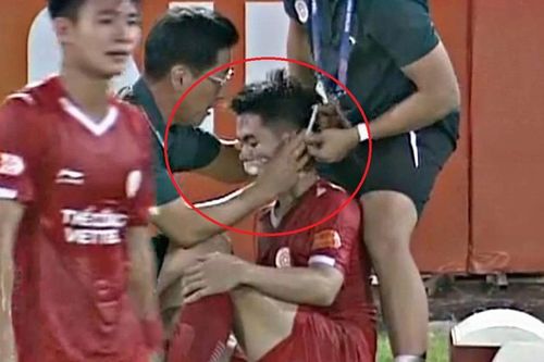 Khuất Văn Khang rách vùng miệng