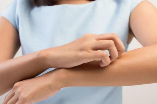 4 loại ngứa báo hiệu bệnh tật khác nhau, cần cảnh giác