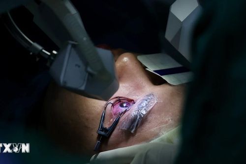 Kỹ thuật chỉnh thị lực bằng điện giúp chữa cận không cần phẫu thuật