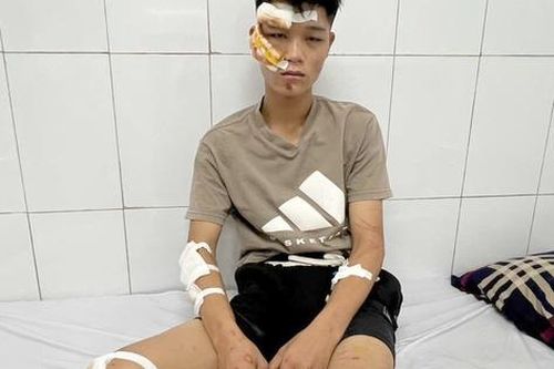 Điều tra tội giết người với 'quái xế' lao xe vào cảnh sát cơ động