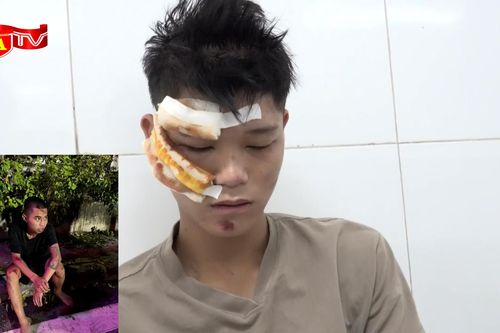 Xử lý nghiêm 2 đối tượng lao xe máy 'thông chốt' đâm trọng thương chiến sĩ CSCĐ