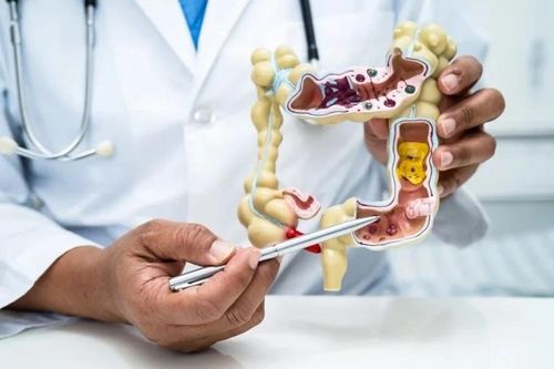 Đi khám vì bệnh tiêu hóa, bất ngờ được chẩn đoán mắc ung thư