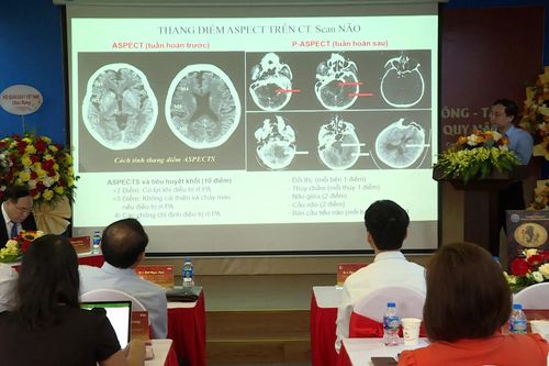 Kết hợp Đông – Tây y: Hướng mới cho điều trị tai biến