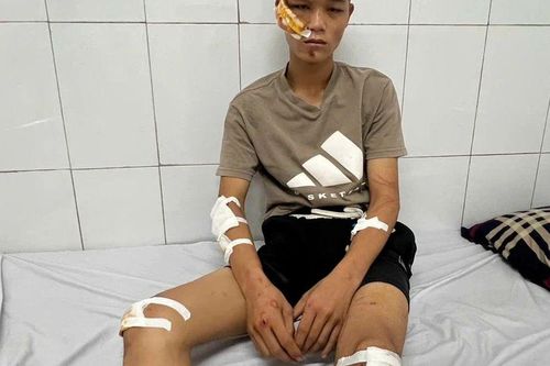 Lời khai gây phẫn nộ của 'quái xế' đâm cảnh sát cơ động chấn thương sọ não: Lỗi chồng lỗi sẽ chịu hình phạt thế nào?