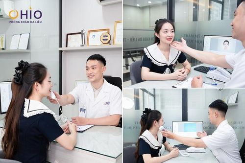 Giãn mao mạch mũi: Nguyên nhân và cách điều trị