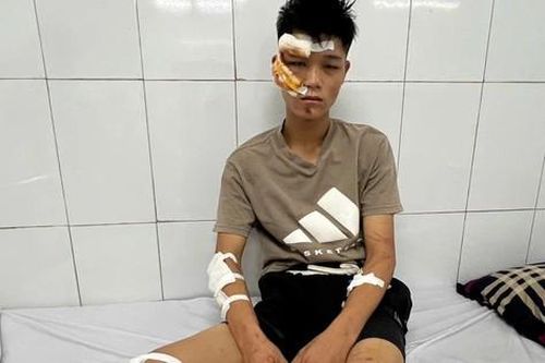 Quái xế 'thông chốt' tông vào Cảnh sát cơ động có thể lĩnh án tới 20 năm tù?