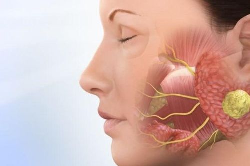 Đau đột ngột như dao đâm vùng hàm mặt cảnh giác với đau dây thần kinh số 5