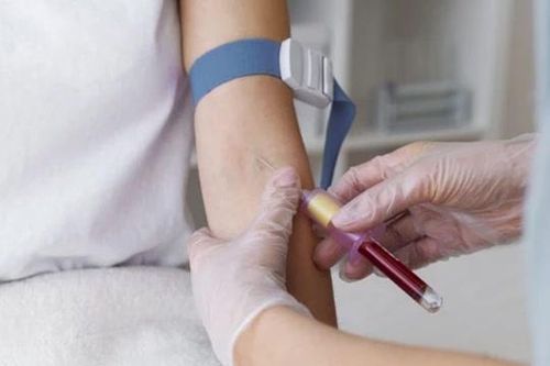 Lý do máu luôn được lấy từ tĩnh mạch thay vì từ động mạch