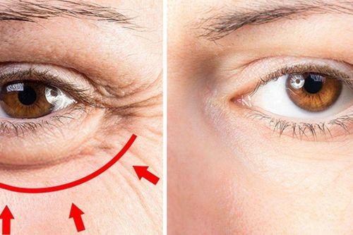 Mắt có 4 thay đổi này, đi khám ngay – dấu hiệu tiềm ẩn nhiều loại ung thư mà ít ai biết