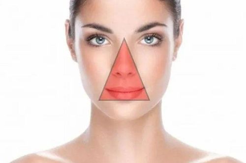 Nặn mụn ở 'tam giác tử thần' trên mặt, người phụ nữ nhập viện khẩn cấp, bác sĩ cảnh báo nguy cơ tử vong