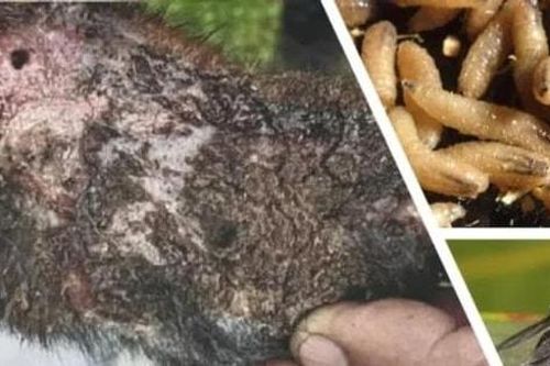 Mỹ phát hiện trường hợp đầu tiên nhiễm giun ăn thịt người
