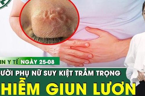 Bản tin Y tế 25/8: Bệnh nhân 86 tuổi tiêu chảy, suy kiệt do nhiễm giun lạ