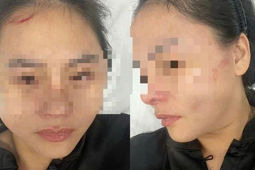 Nữ chủ quán bún riêu hoảng loạn kể lại khoảnh khắc bị chủ nhà khóa cửa, lao vào hành hung