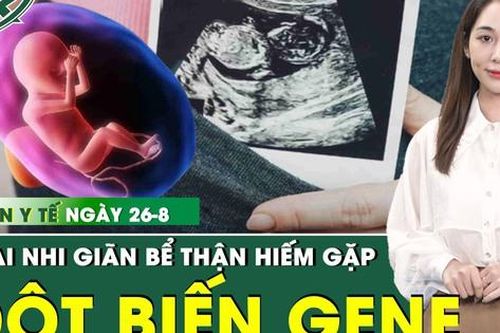 Bản Tin Y Tế 26/8: Thai nhi 28 tuần đa ối, giãn bể thận do đột biến gene
