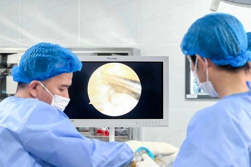 Nội soi khớp gối chỉnh lỏng gối, kém vận động