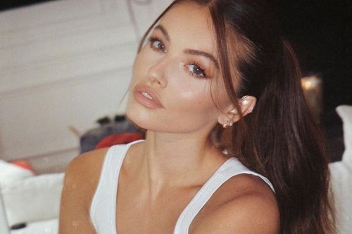 'Người mẫu đẹp nhất thế giới' lên tiếng về tin đồn phẫu thuật thẩm mỹ
