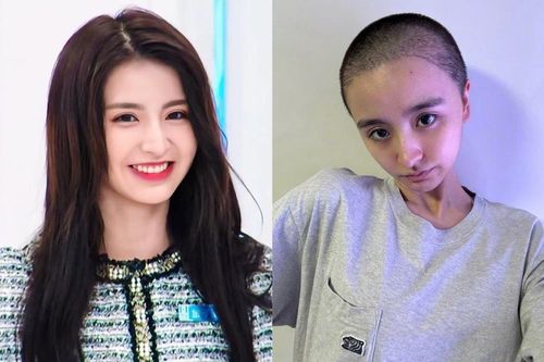 Nữ ca sĩ cạo trọc đầu gây lo lắng