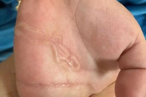 Bàn tay bé trai xuất hiện dấu hiệu lạ, đi khám, bác sĩ phát hiện 'bí mật đáng sợ'