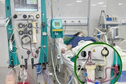 Người phụ nữ 35 tuổi phải lọc máu cấp cứu ngay sau khi sinh con