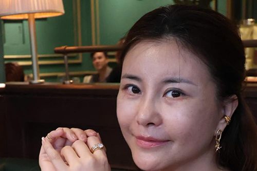 Diễn viên Kim Oanh chi tiền tỷ thẩm mỹ gương mặt, sống độc thân không cầu tình duyên