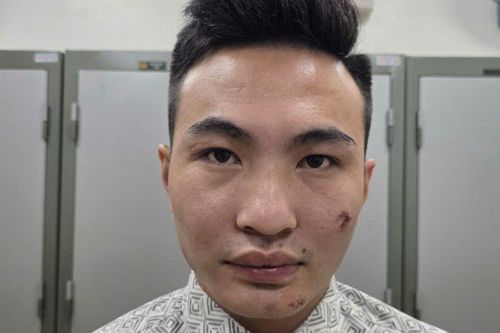 Tạm giữ hình sự Nguyễn Xuân Khải - kẻ lao xe máy vào cán bộ Công an bảo vệ A80