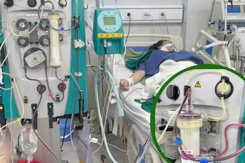 Đau bụng dữ dội khi mang thai, người phụ nữ được phát hiện mắc viêm tụy cấp