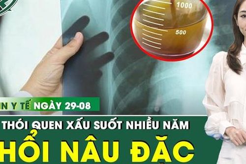 Bản Tin Y Tế 29/8: Phổi đặc với 30 lít dịch đục ngầu do thói quen khó bỏ