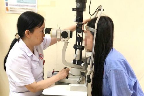 Lạm dụng kính áp tròng, cô gái 20 tuổi gánh hậu quả