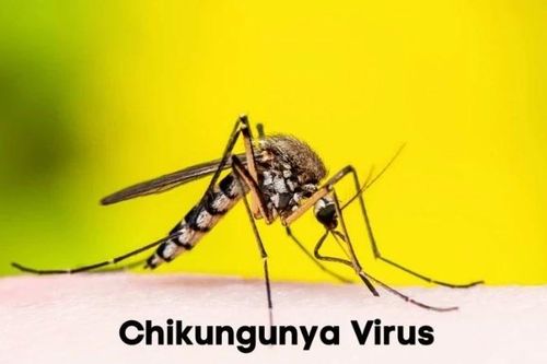 Nga ghi nhận ca sốt chikungunya nhập cảnh đầu tiên năm 2025