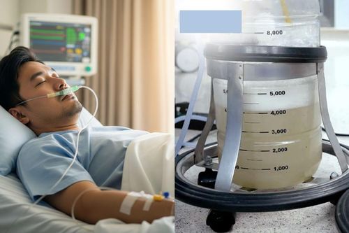 Hút 30 lít dịch đục như bùn từ phổi người đàn ông, nguyên nhân gây rùng mình