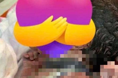 Bé trai chào đời với 6 vòng dây rốn quấn cổ: Điều mẹ bầu nên biết khi thai nhi bị dây rốn quấn cổ