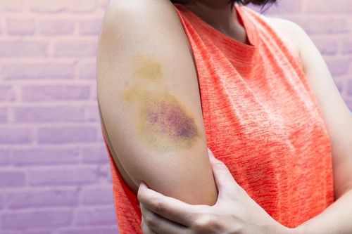 Những dấu hiệu trên da cảnh báo bệnh nguy hiểm