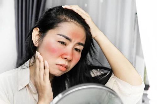 Những dấu hiệu cảnh báo từ làn da bạn không nên bỏ qua