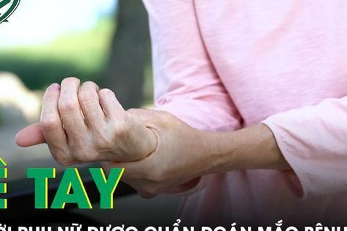 Ba năm tê tay không khỏi, nữ bệnh nhân mắc hội chứng hiếm