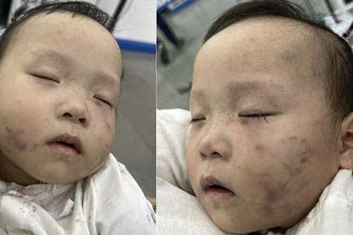 Xác minh, làm rõ vụ việc bé gái 1 tuổi bị thương khi đi học ở Bắc Ninh