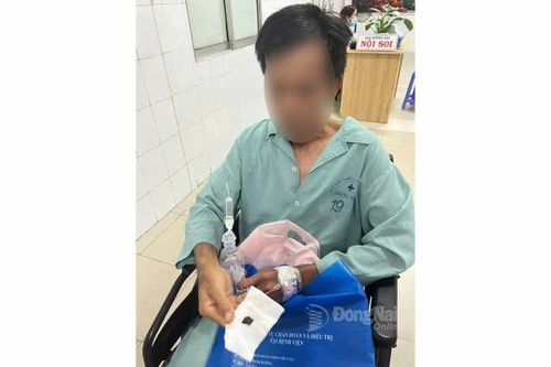 Nội soi gắp dị vật nằm trong phế quản bệnh nhân suốt 1 năm