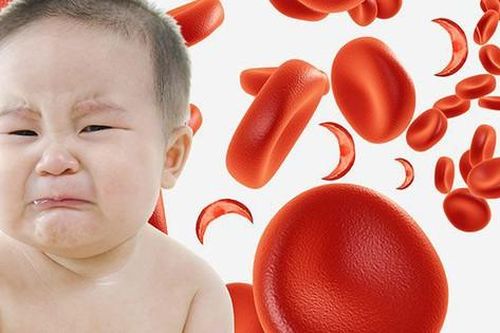5 triệu chứng cảnh báo thiếu sắt ở trẻ em cha mẹ dễ bỏ qua và cách bổ sung an toàn