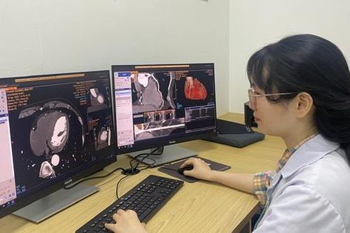 Ứng dụng trí tuệ nhân tạo chẩn đoán chính xác các bệnh lý tim mạch, thần kinh và ung bướu