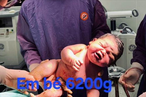 Bé trai chào đời nặng kỷ lục 6,2 kg