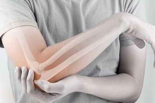 Loãng xương sớm - Dùng thuốc và phòng ngừa như thế nào?