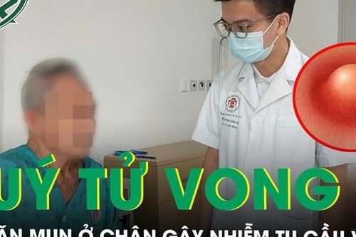 Suýt tử vong vì nặn mụn ở chân gây nhiễm tụ cầu vàng ăn vào cột sống