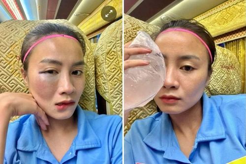 Fan xót xa trước gương mặt sưng vù của hot girl bóng đá Hoàng Thị Loan