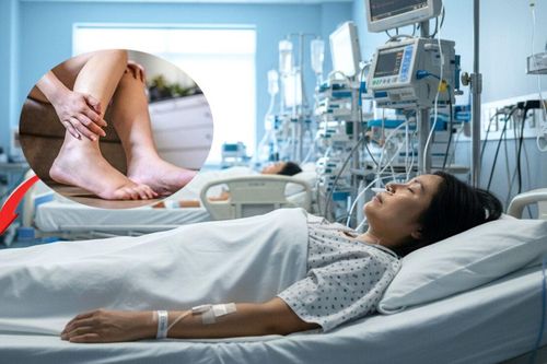Xem kỹ bàn chân, thấy 4 dấu hiệu này cảnh báo nguy cơ ung thư phổi, cần đi khám ngay