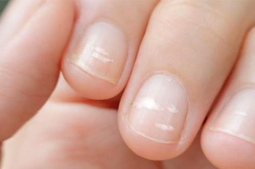 Trên tay xuất hiện 5 thay đổi, coi chừng là tín hiệu ung thư